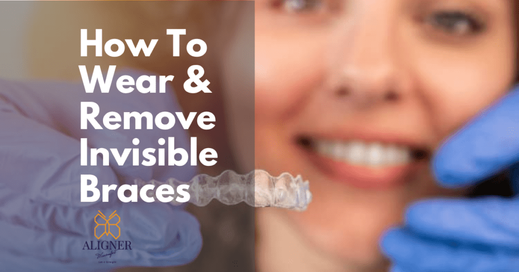 How To Wear Invisible Braces & Remove It by Alignerwisecomfort