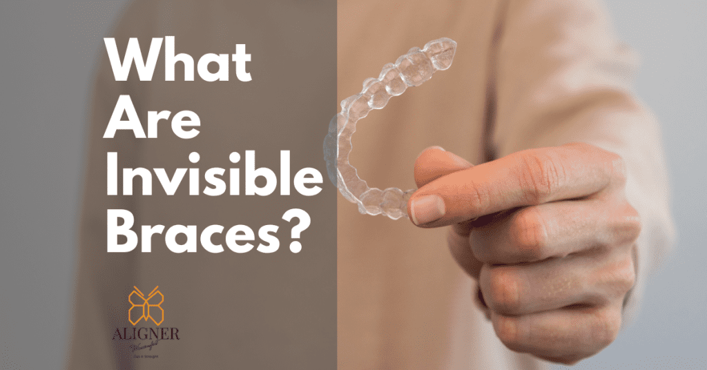 What Are Invisible Braces aka Clear & Transparent Braces