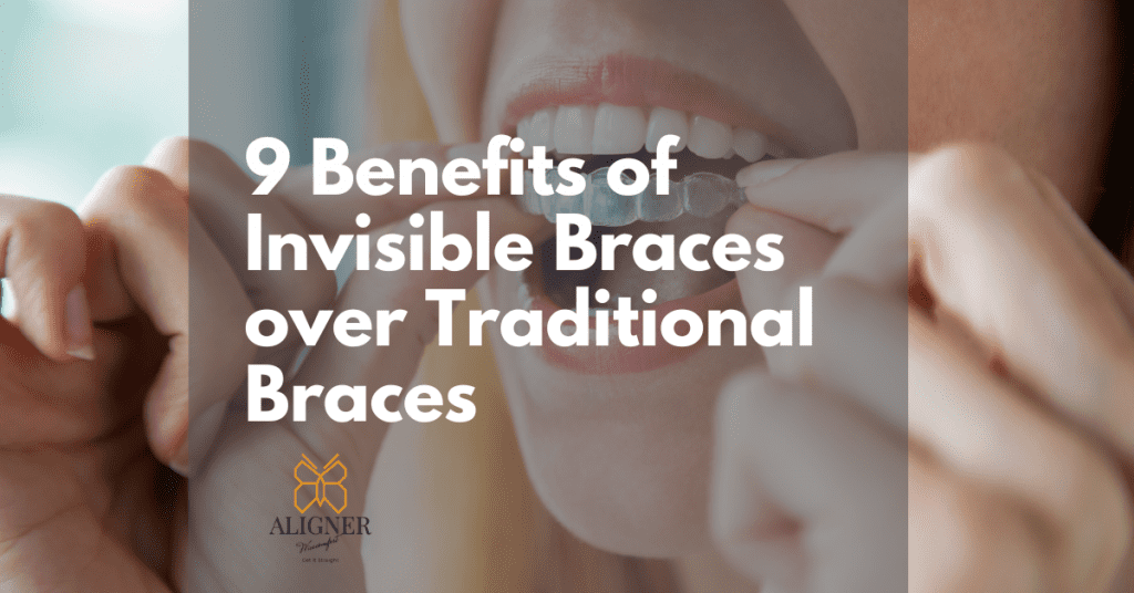 9 benefits of invisible braces over traditional braces by Aligner WiseComfort