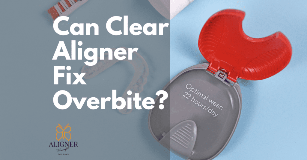Can Clear Aligner Fix Overbite Issue? A full guide by aligner wisecomfort
