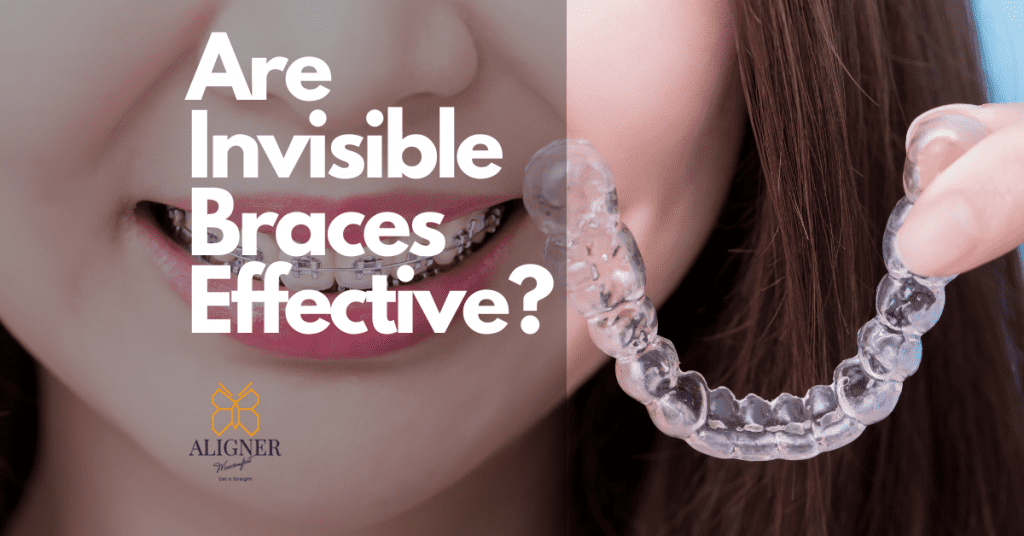 Learn about the fact or invisible braces & answering the ultimate question are invisible braces effective? Lady holding invisible braces with nice aligned white teeth