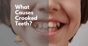 What causes crooked teeth