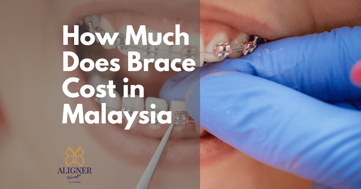 How Much Does Braces Cost in Malaysia | Full Guide [2023]